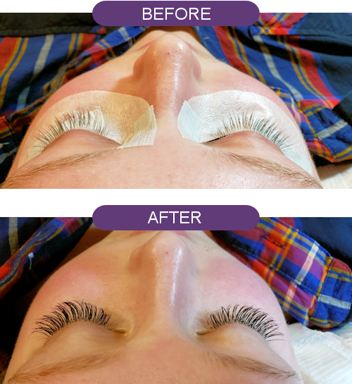 Eyelashes